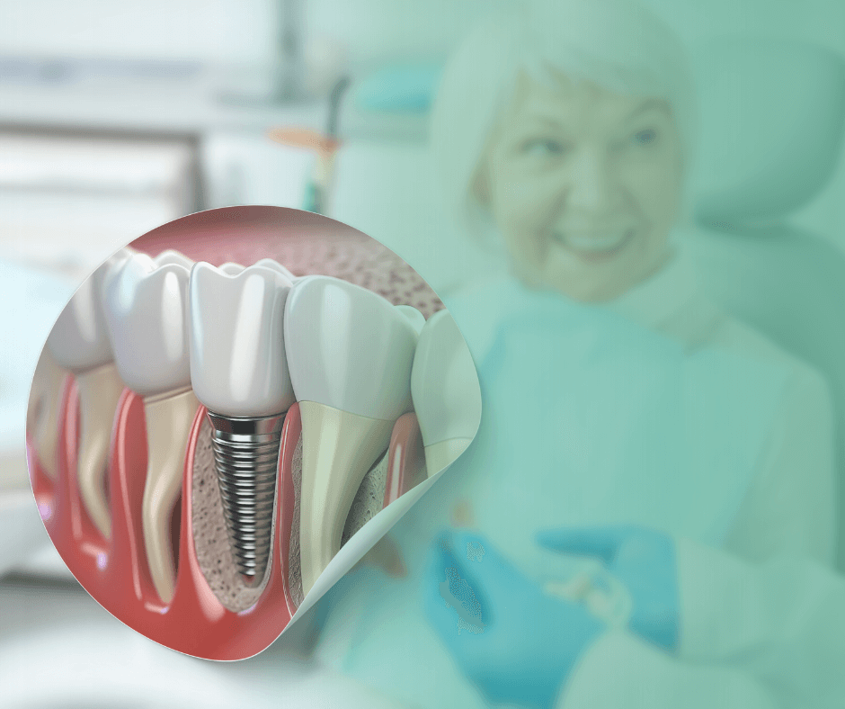 Cirugía e Implantes