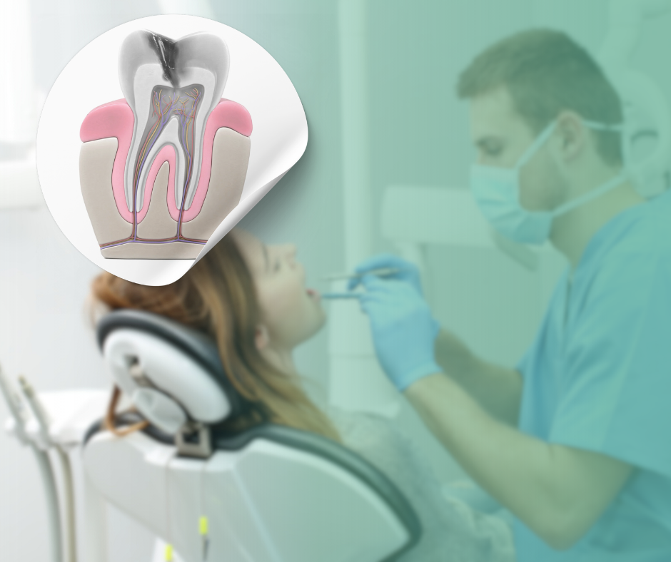 Endodoncia