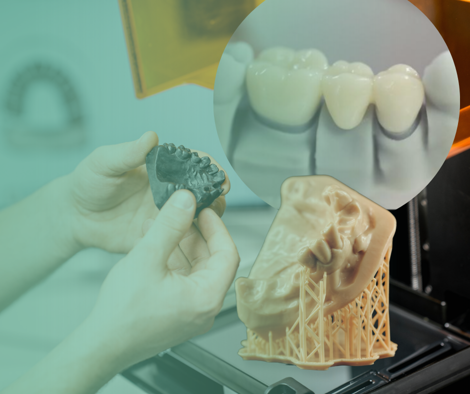 Impresión 3D